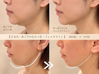 ビビラフィネ(BiBi Raffine)の写真