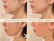 ビビラフィネ(BiBi Raffine)の写真