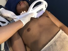 エピラージュ 伊勢崎店/全身脱毛でツルツル！