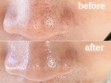 メモリ/お客様の変化