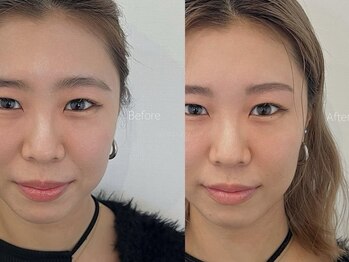 ワクシー 麻布十番店(WAXYYY.)/ハリウッドブロウリフト¥3,900～