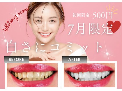エクシアホワイトニング 京都四条店の写真