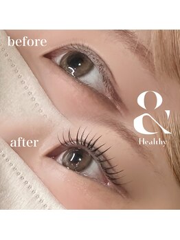 クロムネイル(CHROMNAIL)/&healthy120本