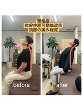 アンティオール 古河店/首の痛みに！【古河　整体】