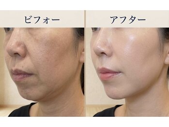 ラシクビューティールームの写真/気になり始めたシミ・しわに　ふと気づく年齢サイン　これからの肌を整えるケア