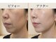 ラシクビューティールームの写真/気になり始めたシミ・しわに　ふと気づく年齢サイン　これからの肌を整えるケア
