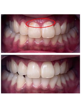 ホワイトベース(White base)/1度でも着色がここまで落ちる!