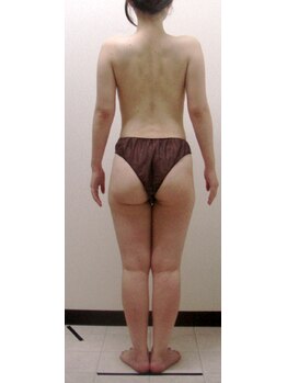 ジョイア 本店(Beauty＆Detox gioia)/安曇野市20代のお客様アフター