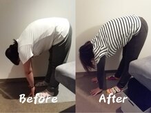 クーオス(KuuOs)/【30代/女性】6回の施術後変化