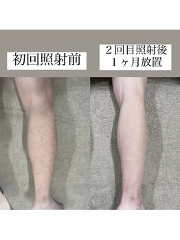 テンパ ビューティー(+10%beauty)/効果写真