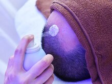 ヘッドミントアロマ 栄東新町本店/オプション炭酸（頭皮の悩み）