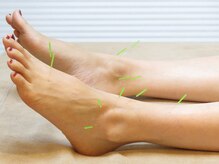 按鍼道/足のむくみ1