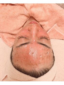 ヴィエンナ VIENNA/セルボンバー核酸×ドイツハーブ