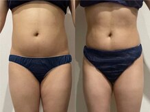 プリオール 太田店(Prior)/インド痩身