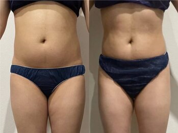 プリオール 太田店(Prior)/インド痩身