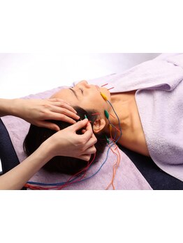 鍼灸施術を受けたい