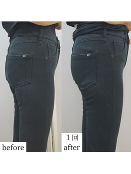 アップルミント/＜痩身＞before・after