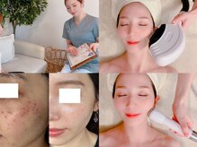 ローズルート(Rose route)の雰囲気(【シミが消・える】即実感!最先端機器で頑固なシミと決別美肌へ)