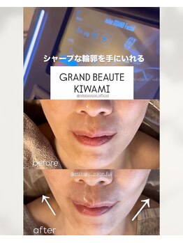 フル(Full)/【グランボーテKIWAMI】