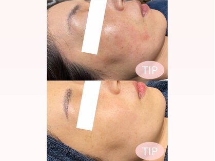 ラボーテエサンテ バイ ティアラ(la beaute et sante by Tiara)の写真