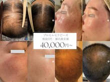 オウジエステサロン(OJIエステサロン)