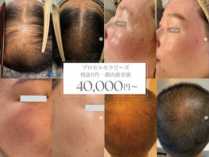 オウジエステサロン(OJIエステサロン)の写真