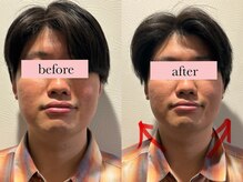 エネ ラッシュアンドブロウ バイ アンドエラ(ENNE Lash&Blow by&ERA)/美脳トレーニングスパ&小顔整体