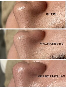 アンドエルビオ(&Elbio)/毛穴洗浄