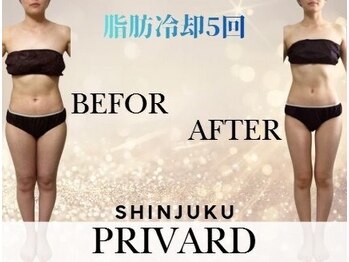 プリバード 新宿店/脂肪冷却5回