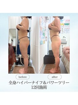 エスプレッソ(espresso,)/【全身痩身】長年のお悩み解決☆