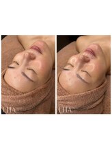 ピュアソル 奈良店(Puresol)