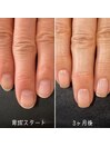 自爪育成3ヶ月コース