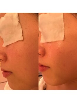 凪 横浜/お肌を綺麗に。