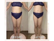 ヒトハナ(hitohana)/1回でお腹スッキリ！！