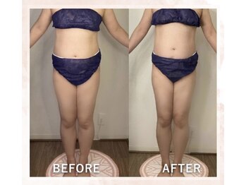 ヒトハナ(hitohana)/1回でお腹スッキリ！！