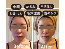 【効果重視】幅広い世代から支持が高い★美容機器選びは大切です