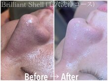 ブリリアント シェル(Brilliant Shell)の雰囲気（エステ初めての方も大歓迎です！安心してご来店ください(^^)）