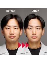 メンズメイク コレクション 名古屋店/Before After