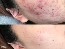 ビアンカ/お客様のお声