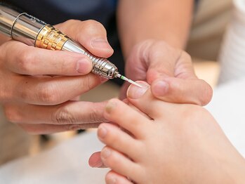 距骨サロン 洗足店の写真/《綺麗な仕上がりが評判☆》特許取得の補正技術で巻き爪の痛みをスグに軽減♪距骨とセットで再発防止もOK!