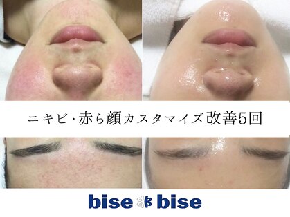 ビズビズ 天王寺店(bisebise)の写真