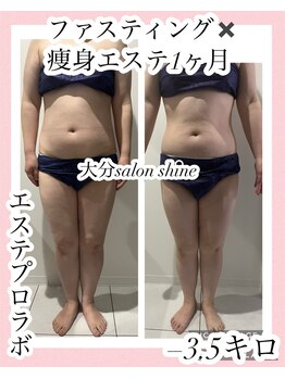サロンシャイン(Salon Shine)/1か月集中ダイエット結果