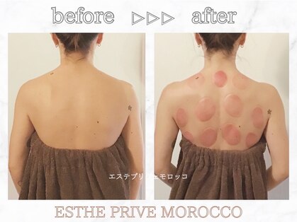 エステプリヴェモロッコ(ESTHE PRIVE MOROCCO)の写真