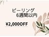 ピーリング6週間以内 ¥2,000OFFクーポン♪