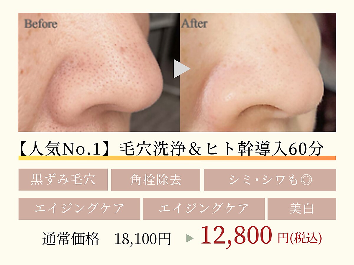 岩槻駅で毛穴洗浄・毛穴吸引が人気のエステサロン｜ホットペッパー