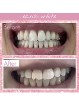 エクシアホワイト 長野店/