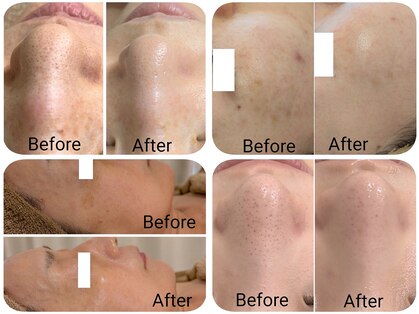 アン(anne)の写真