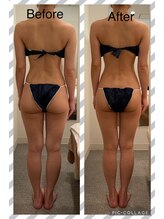 いおり骨盤整体 リブート(RE:BOOT)/セレクト痩身