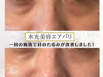 プリンセスフォー/ビフォーアフター☆