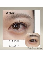 ルナ(LuNa)/まつげエクステ×ラッシュリフト